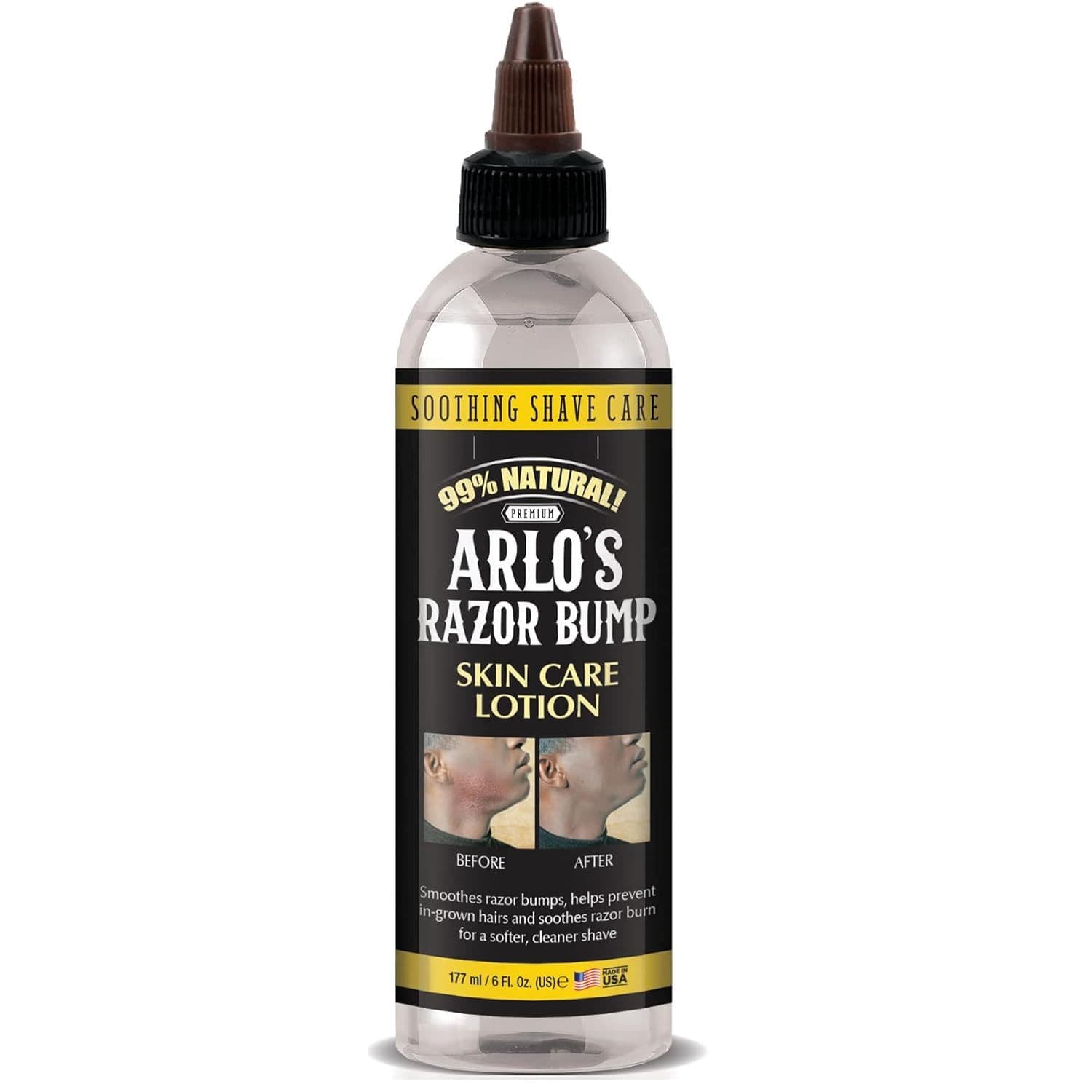ARLO'S RAZOR BUMP SKIN CARE LOTION 177