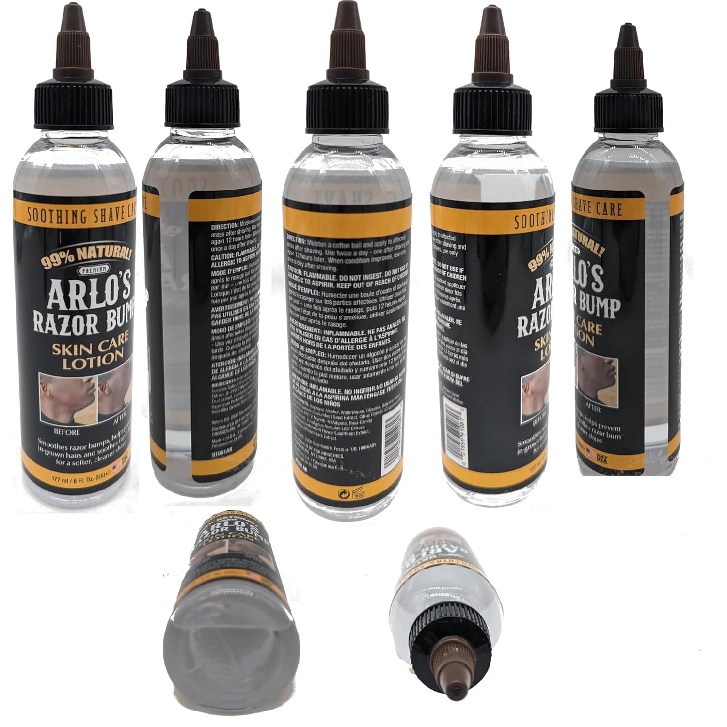 ARLO'S RAZOR BUMP SKIN CARE LOTION 177 2